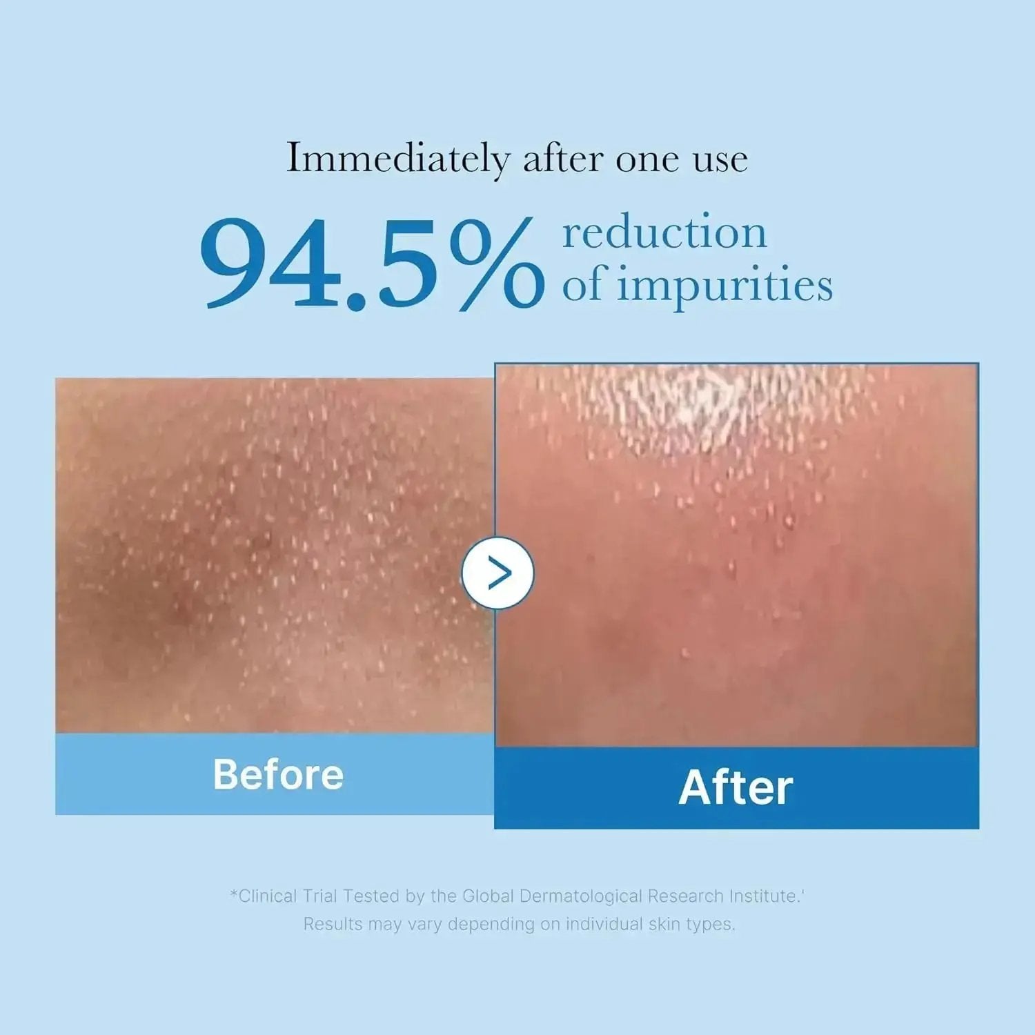 MEDICUBE Zero Pore Blackhead Deep Cleansing Oil 205 ML Medicube