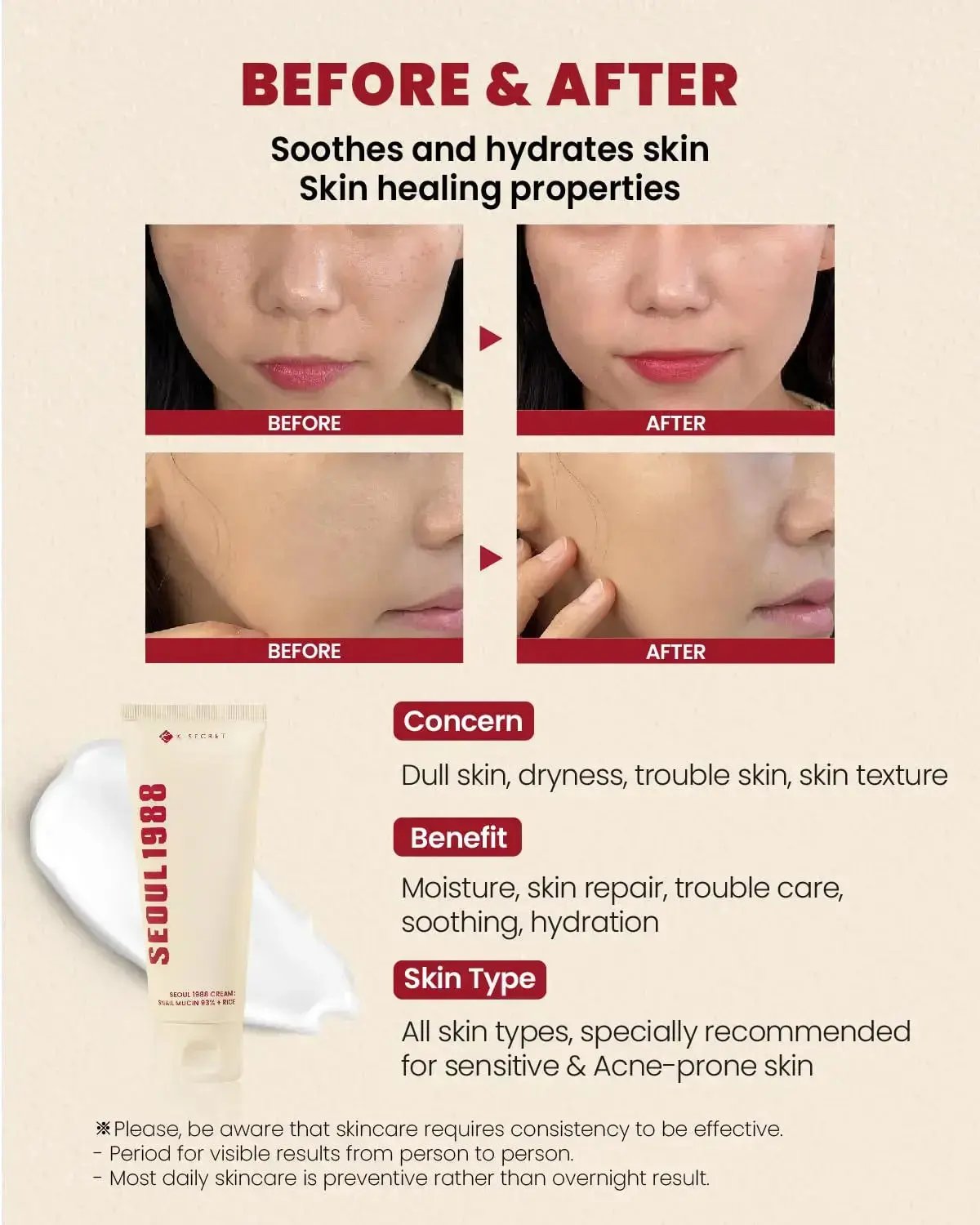 SEOUL 1988 Cream: Snail Mucin 93% + Rice 100 ml SEOUL 1988