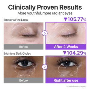 No.9 NAD+ Retinol Volumetox Eye Cream numbuzin