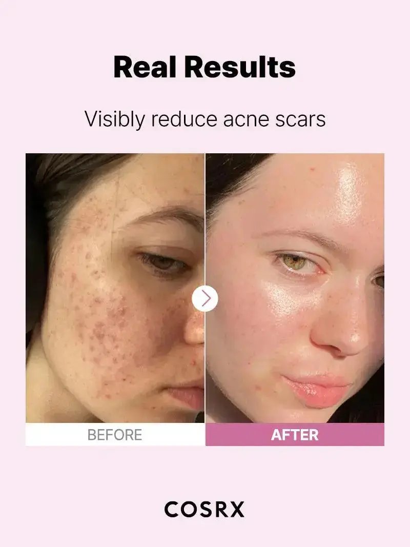 COSRX The Niacinamide 15 Serum 20 ml COSRX