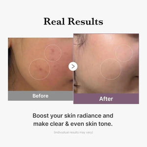 MEDICUBE Age-R Glutathione Glow Toner 140 ML Medicube