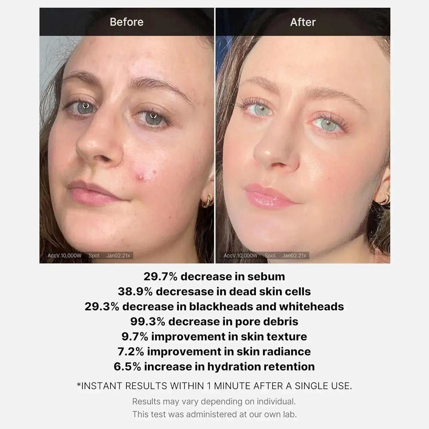 MEDICUBE Red Acne Succinic Acid Peel Serum 40 gm Medicube
