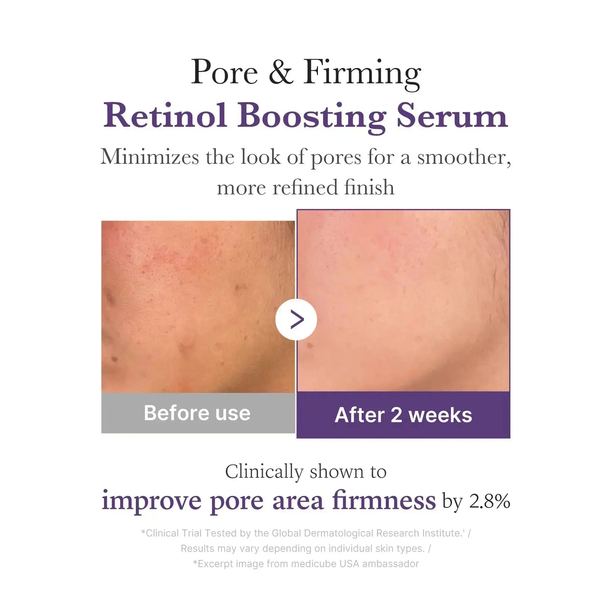 MEDICUBE Retinol NMN Radiance Booster 1.9% Serum 30 ml Medicube
