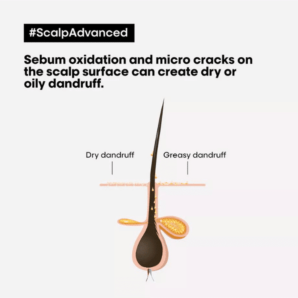 Serie Expert Scalp Advanced Anti-Dandruff Dermo-Clarifier Shampoo 300ml L'OREAL PROFESSIONNEL