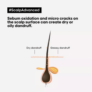 Serie Expert Scalp Advanced Anti-Dandruff Dermo-Clarifier Shampoo 300ml L'OREAL PROFESSIONNEL
